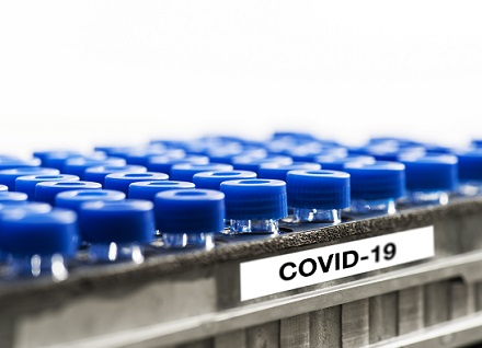 COVID-19-testtubes.jpg